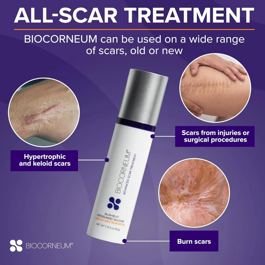 Biocorneum® Advanced Scar Treatment with Silishield® & SPF 30 20g - Image 4