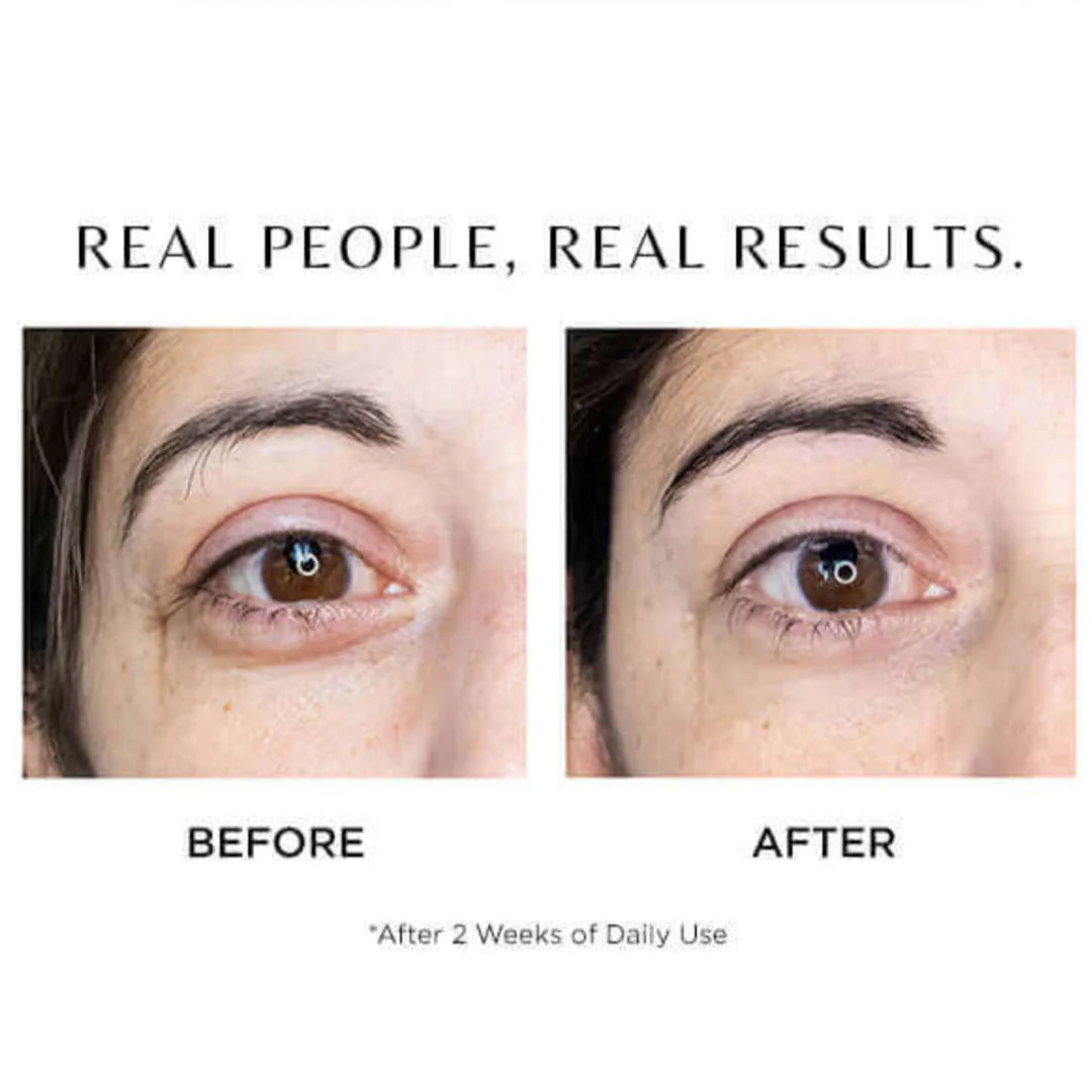 Cosmedix® Elite I-Complex Advanced Eye Gel 0.34 fl oz. / 10 ml - Image 3