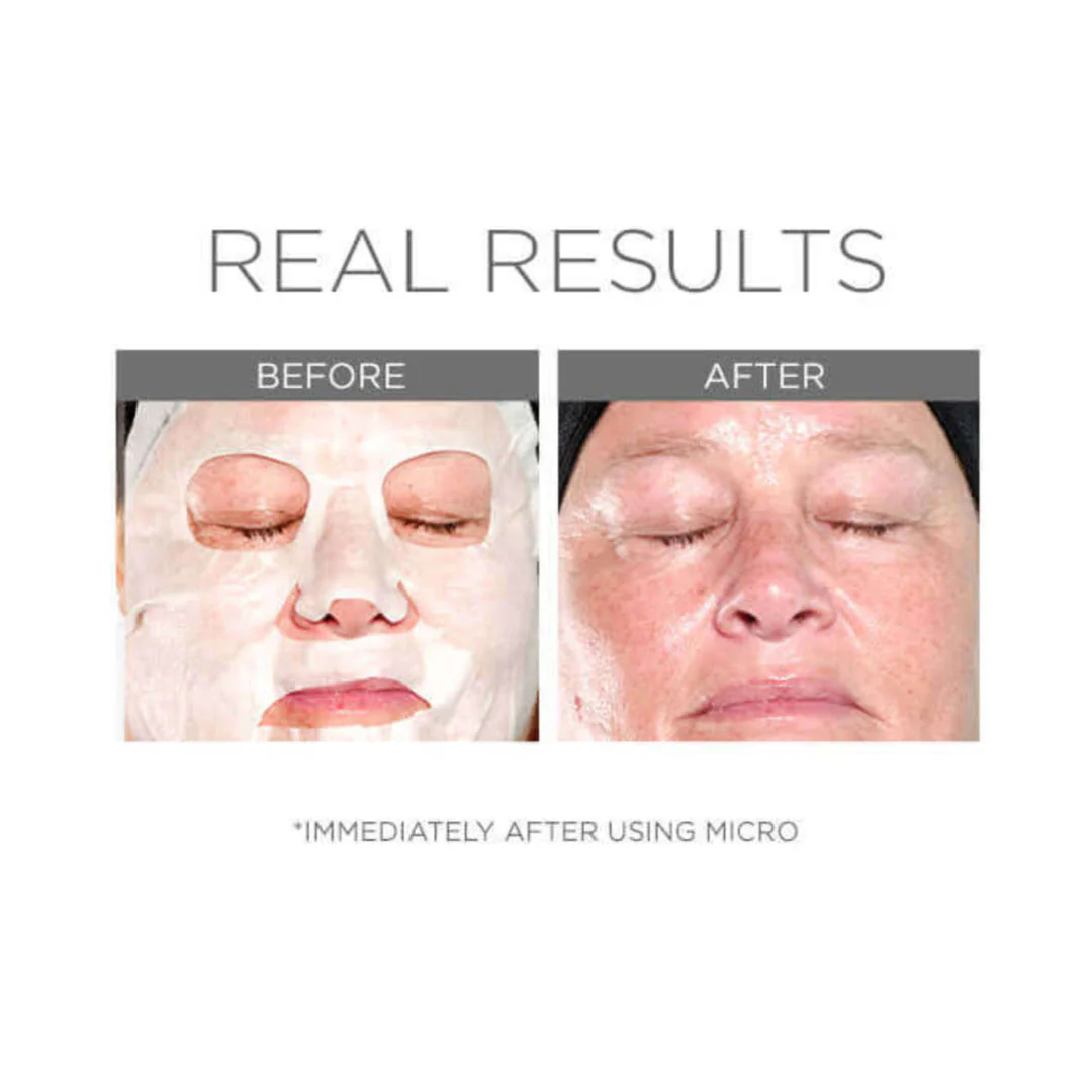 Cosmedix® Micro Defense Microbiome Sheet Mask 5 Masks - Image 3