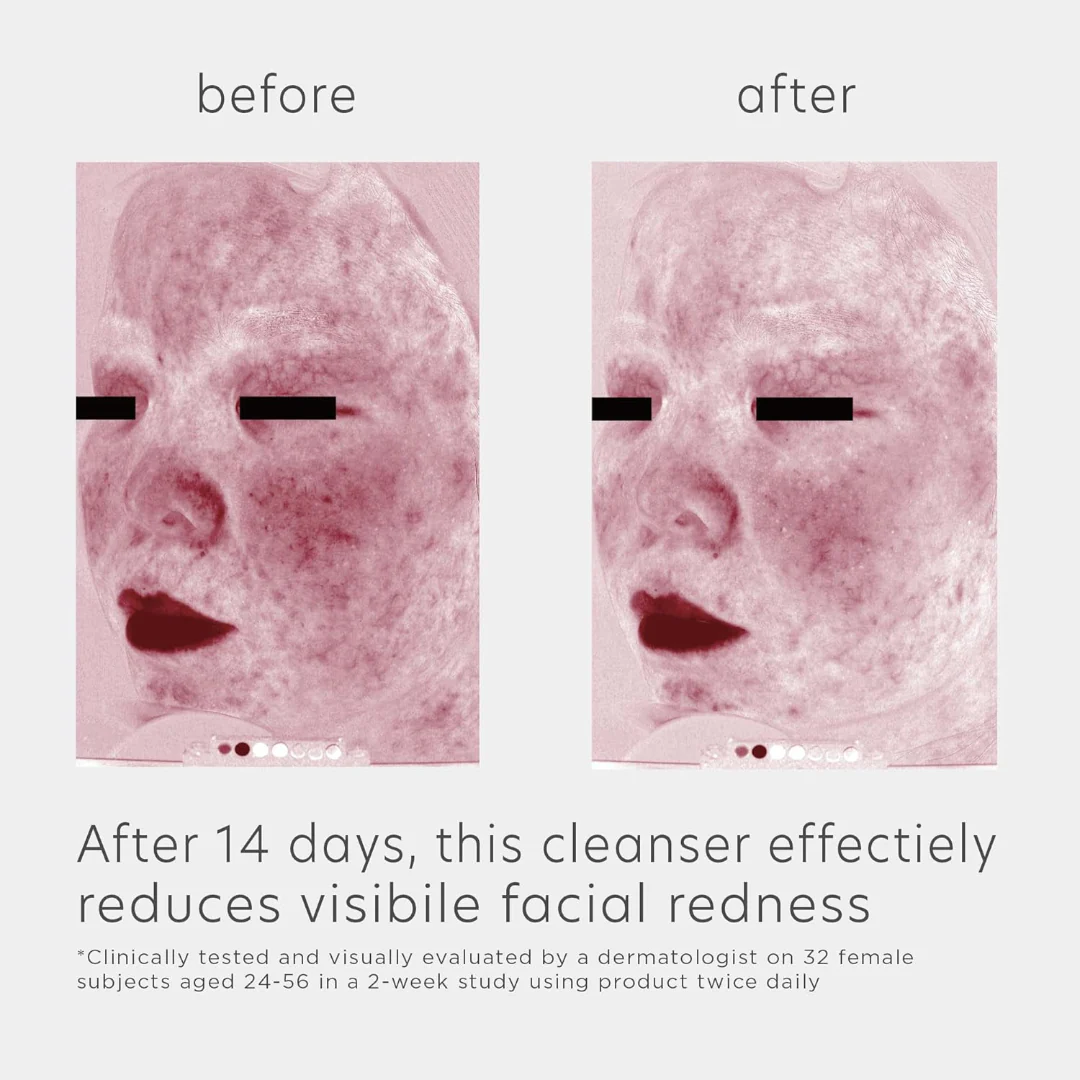 EltaMD® Skin Recovery Amino Acid Foaming Cleanser 1 oz - Image 3