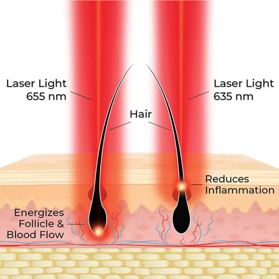 HairMax® Actonis 18 Dual Action LaserComb - Image 4