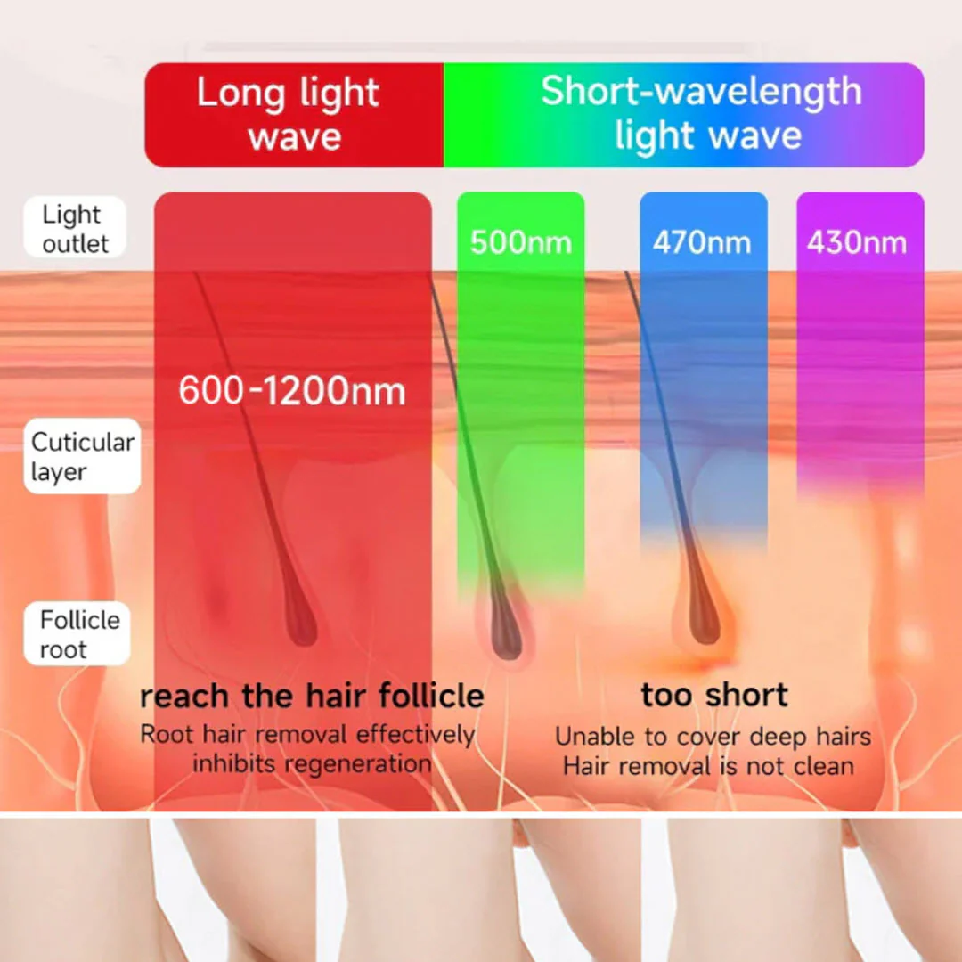 LuminaNRG® Numiere IPL Hair Removal with Ice Cooling - Image 4