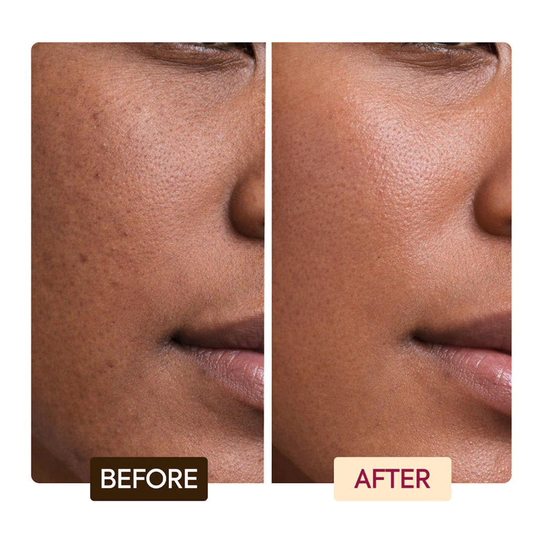 MAKARI® Brightening Exfoliating Antiseptic Soap 7 oz - Image 5