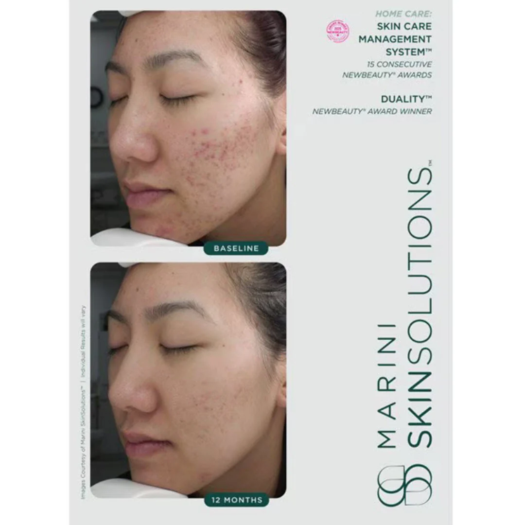 Marini SkinSolutions® Duality Acne Treatment Cream & Anti-Aging Complex 1.0 fl oz - Image 5