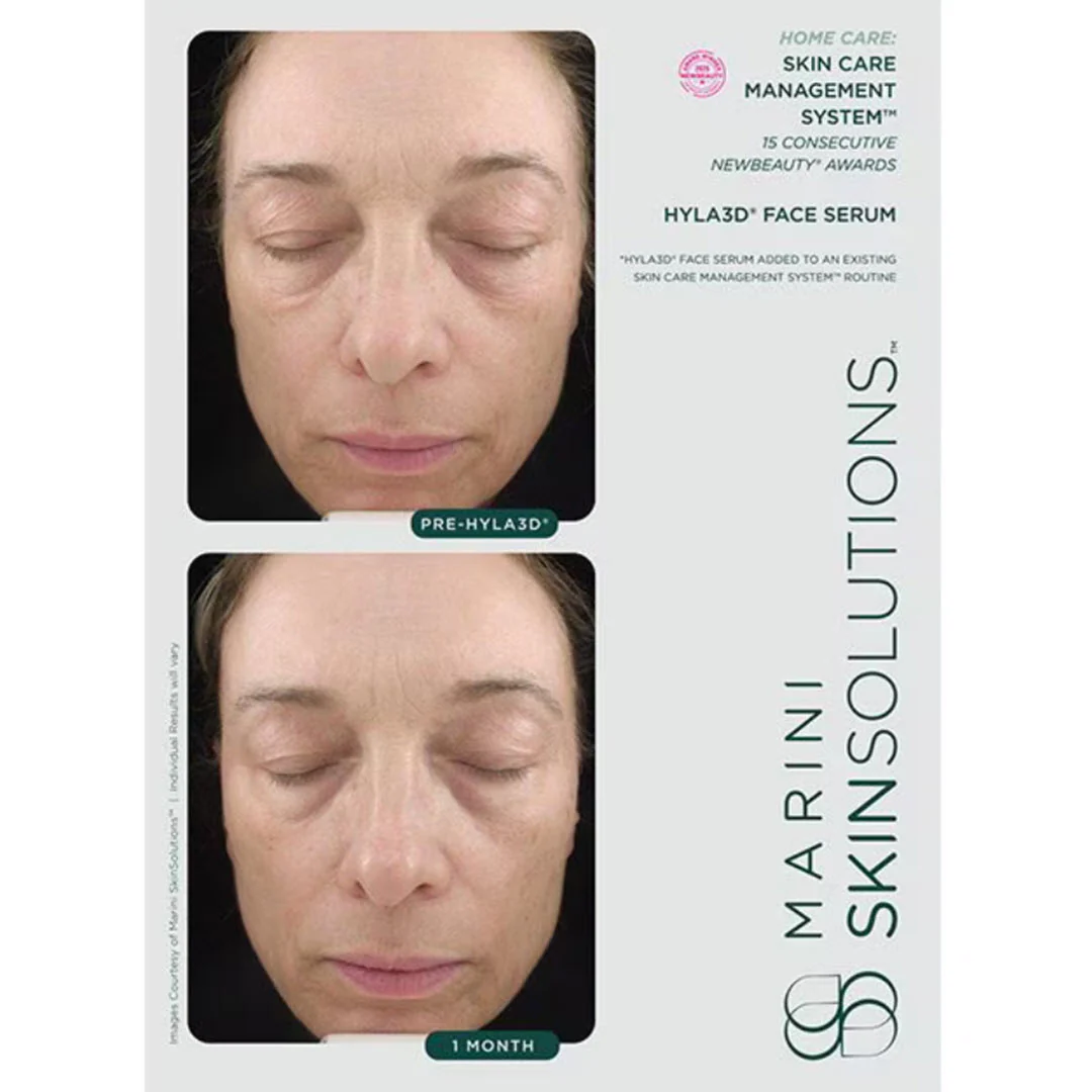 Marini SkinSolutions® Hyla3D® Face Serum Hyaluronic Acid Complex 1 fl oz - Image 3