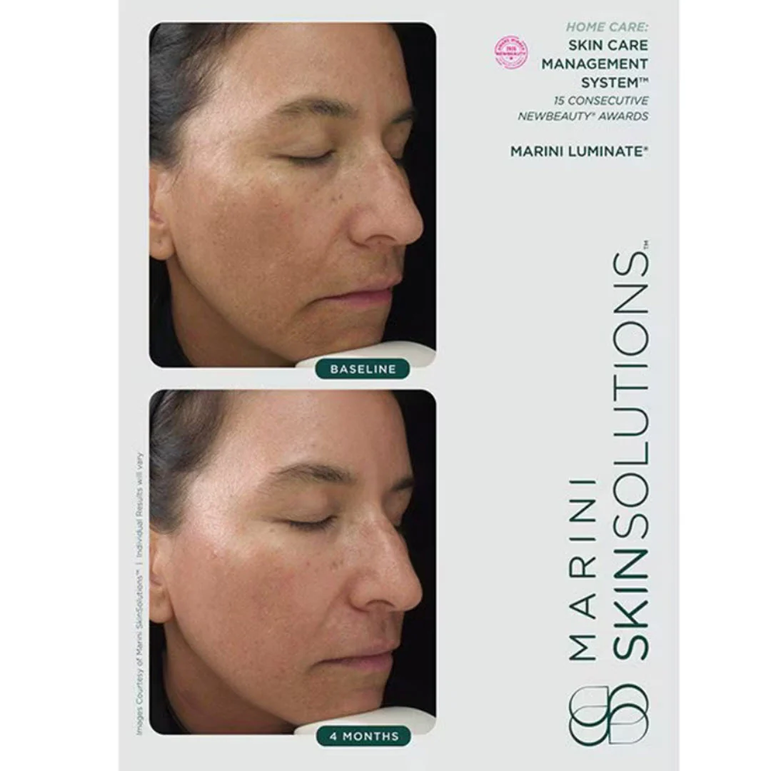 Marini SkinSolutions® Marini Luminate Face Lotion 1 fl oz - Image 3