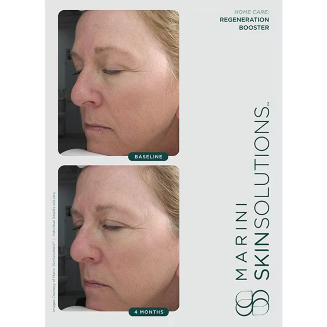 Marini SkinSolutions® Regeneration Booster Face Lotion 1 fl oz - Image 3