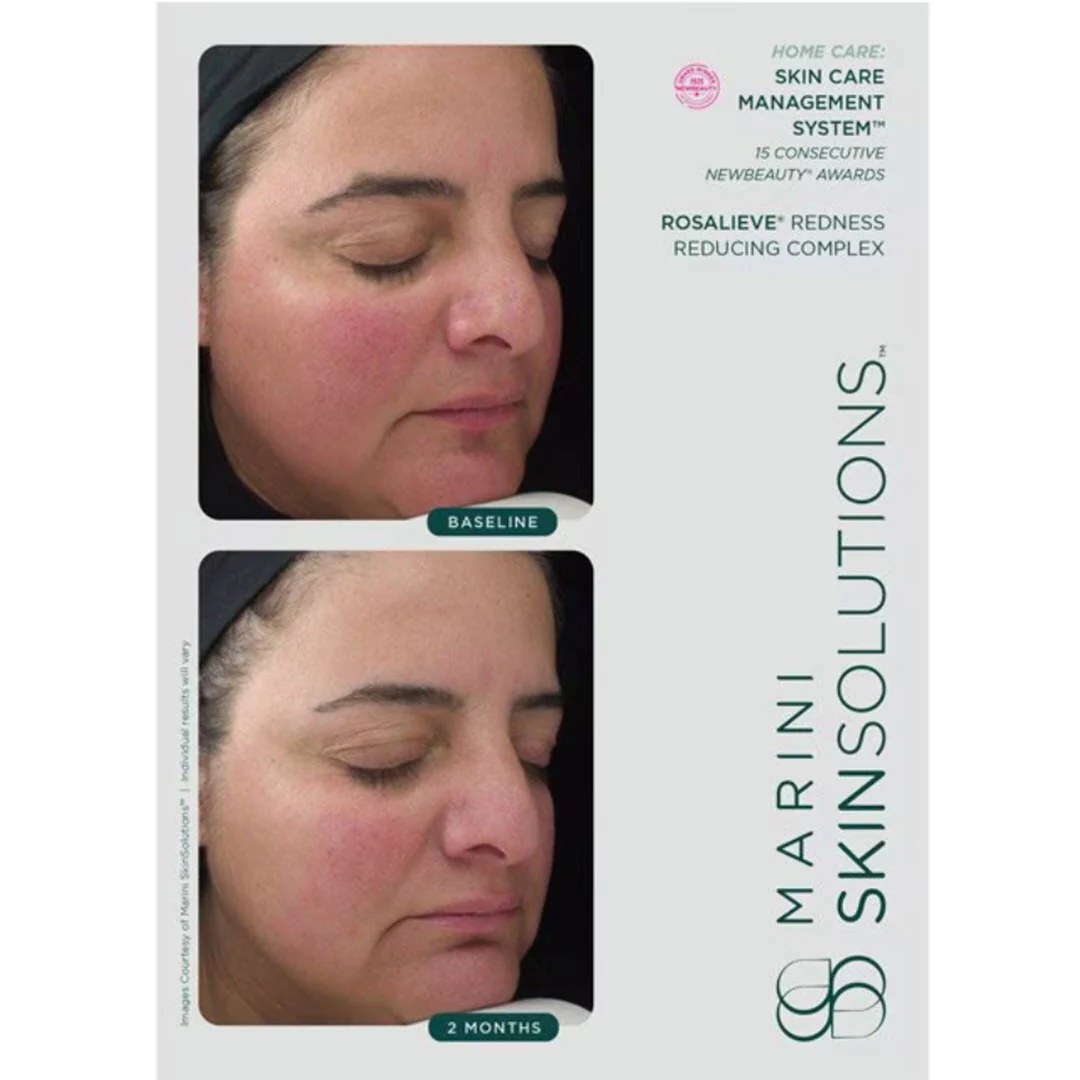 Marini SkinSolutions® RosaLieve® Redness Reducing Complex 1 fl oz - Image 3