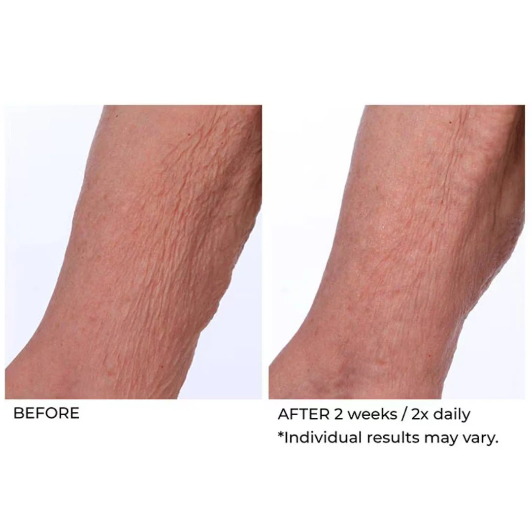 NassifMD® Crepe Inhibitor Triple Action Body Butter 8.0 oz - Image 3