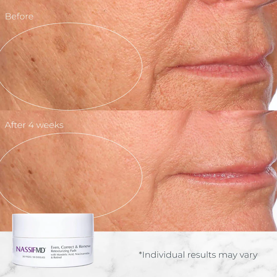 NassifMD® Even, Correct & Renew Retexturizing Treatment Pads 30 Pads - Image 4