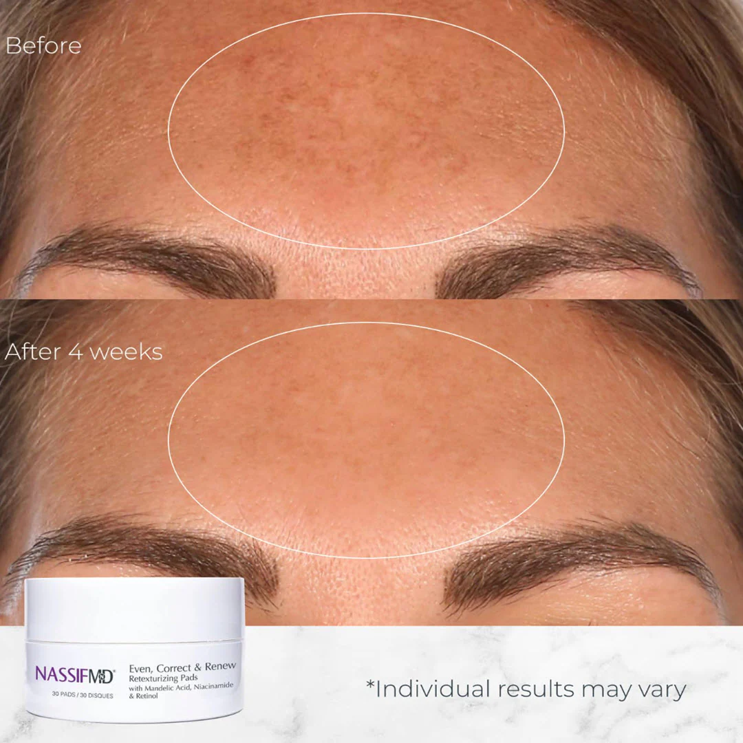 NassifMD® Even, Correct & Renew Retexturizing Treatment Pads 30 Pads - Image 5
