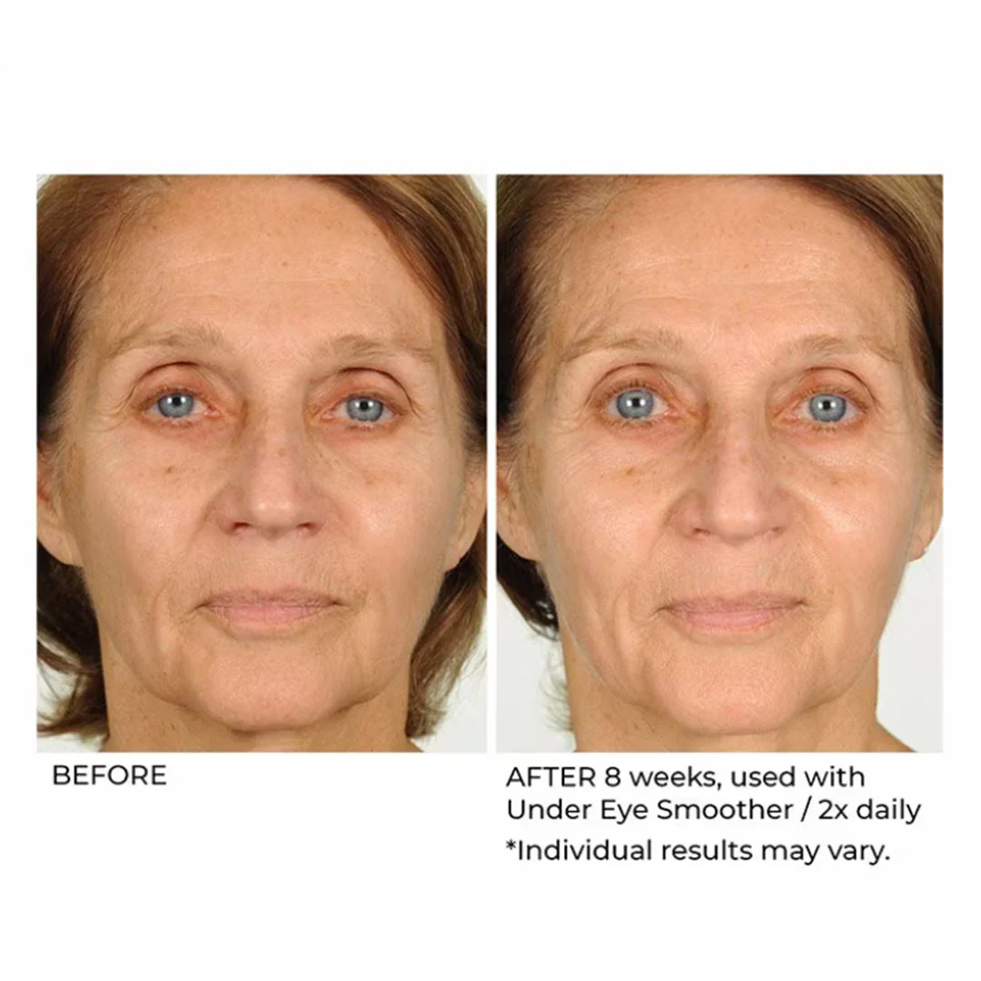 NassifMD® Hydro-Screen Hydrating Serum 2.0 fl oz - Image 3