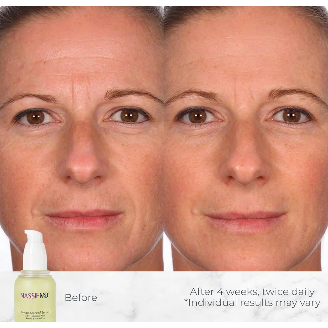 NassifMD® Hydro-Screen Hydrating Serum 4.0 fl oz - Image 4