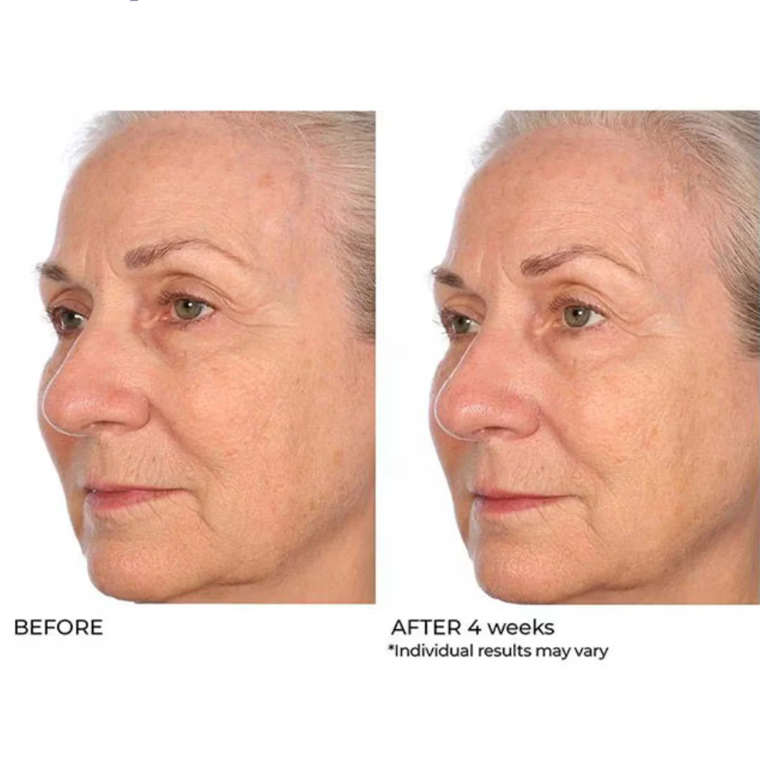 NassifMD® Pro Peptide Collagen Serum 1.0 fl oz - Image 3