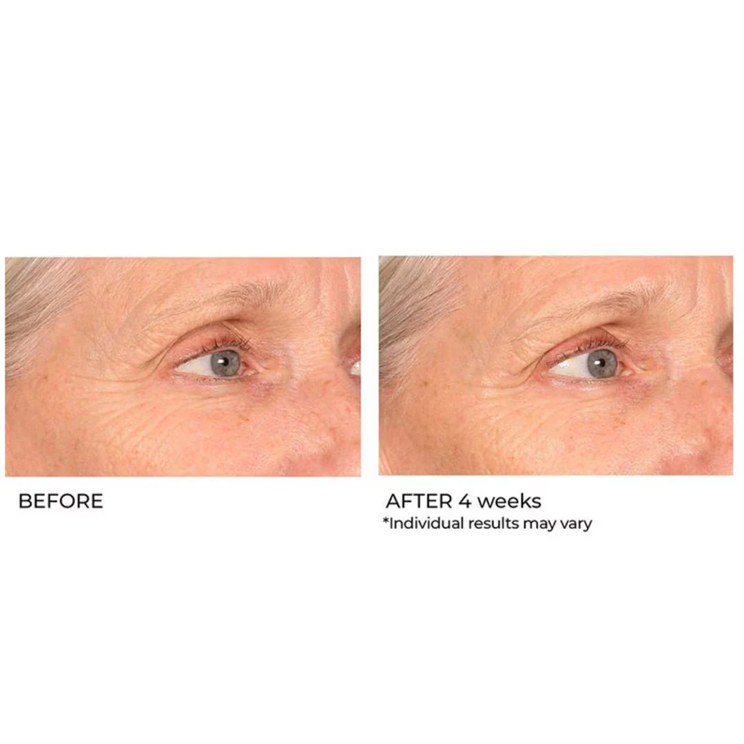 NassifMD® Pro Peptide Collagen Serum 1.0 fl oz - Image 5