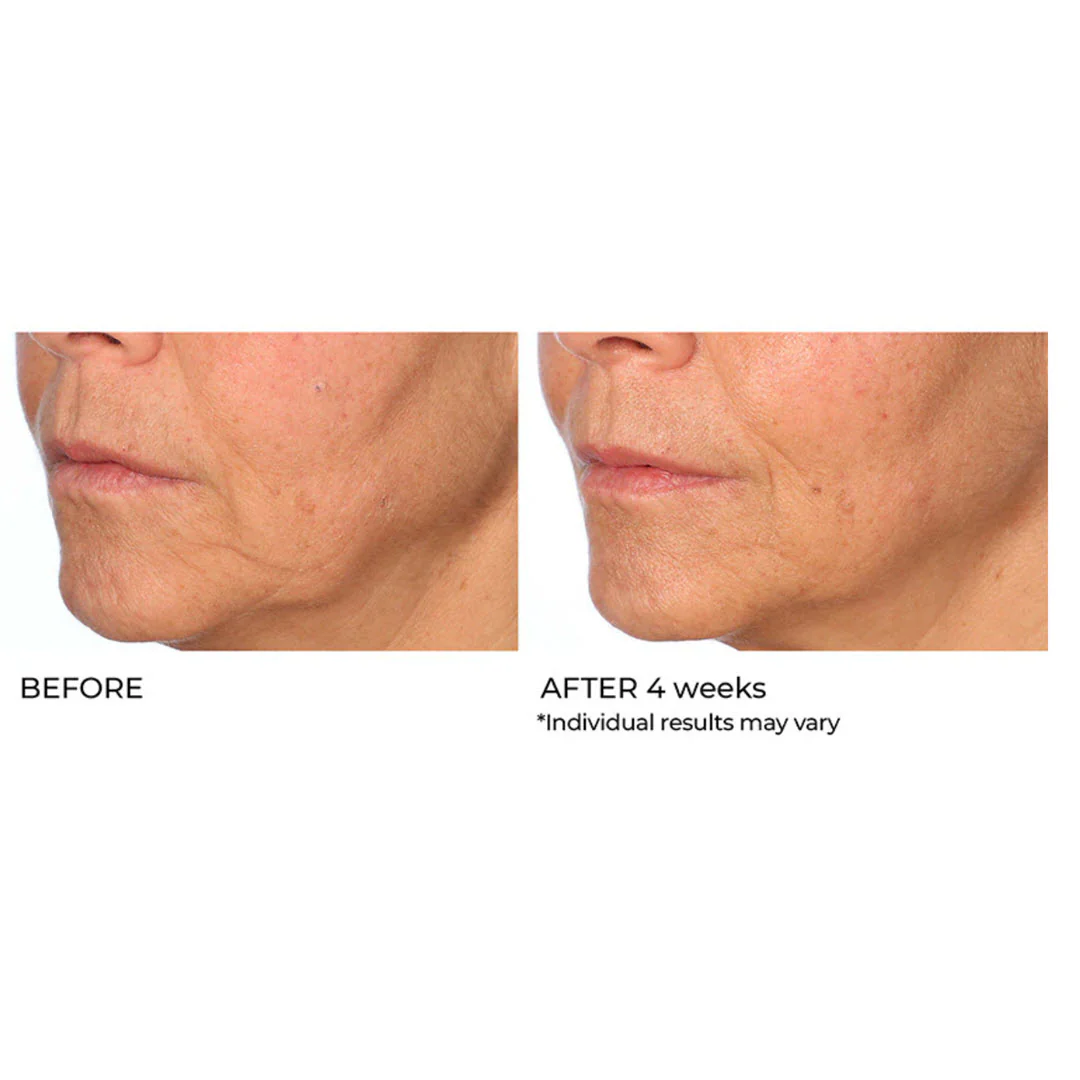 NassifMD® Radiance Brightening Vitamin C Booster Serum 1.0 fl oz - Image 3