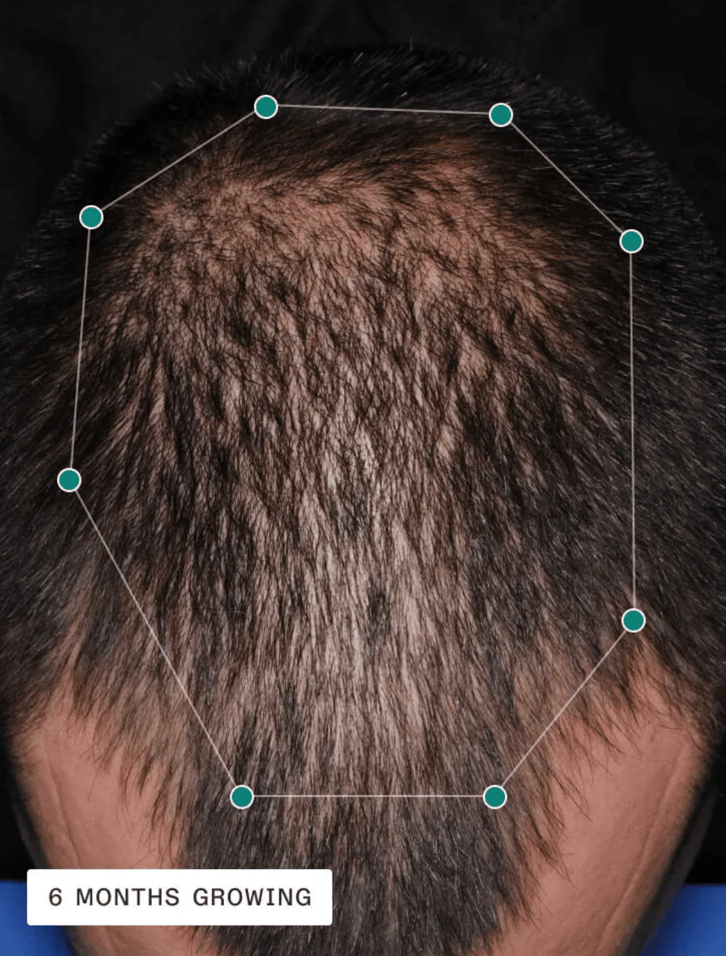Nutrafol® Men's Hair Growth Nutraceutical - 1-Month Supply - Image 4