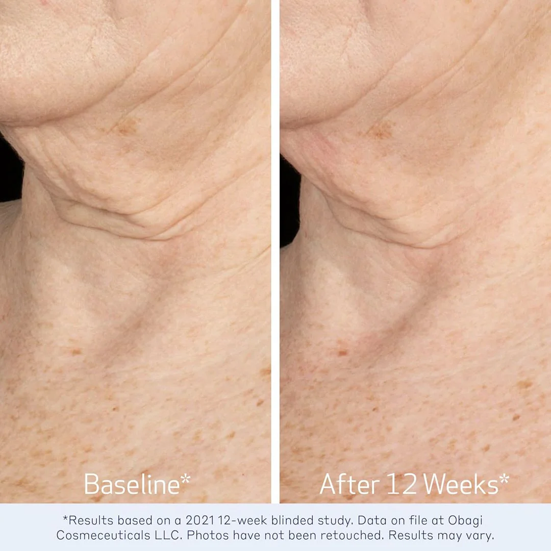 OBAGI® ELASTIderm® Neck and Décolleté Concentrate 2oz - Image 4