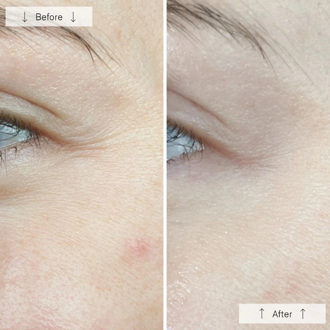 Omnilux® Contour Face - Image 10