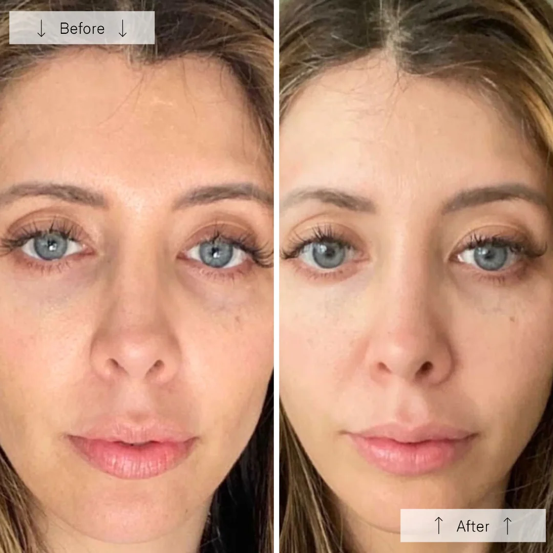 Omnilux® Contour Face - Image 11