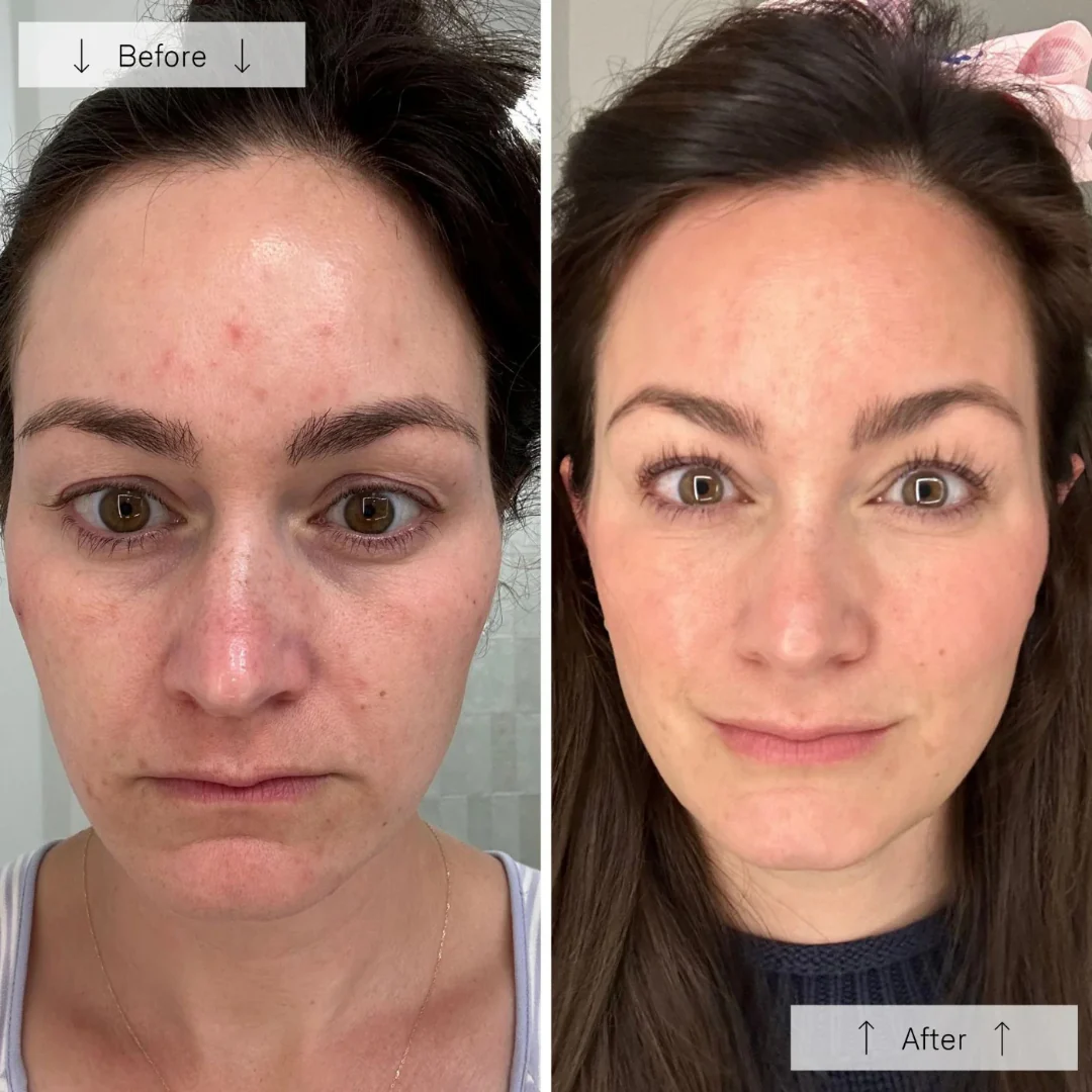 Omnilux® Contour Face - Image 14
