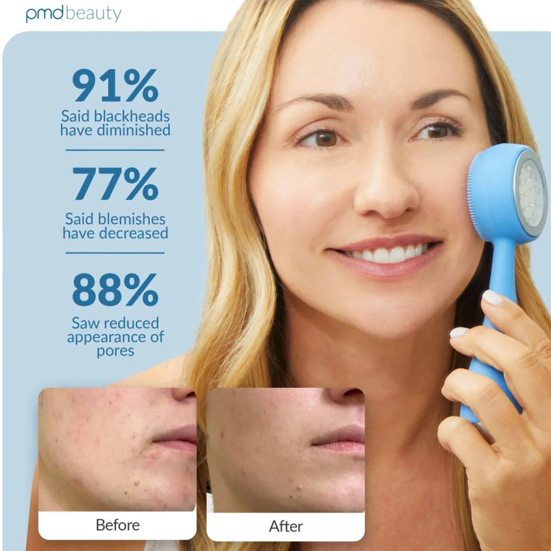 PMD® Clean Acne Blue Light LED Smart Facial Cleansing Device - Image 5