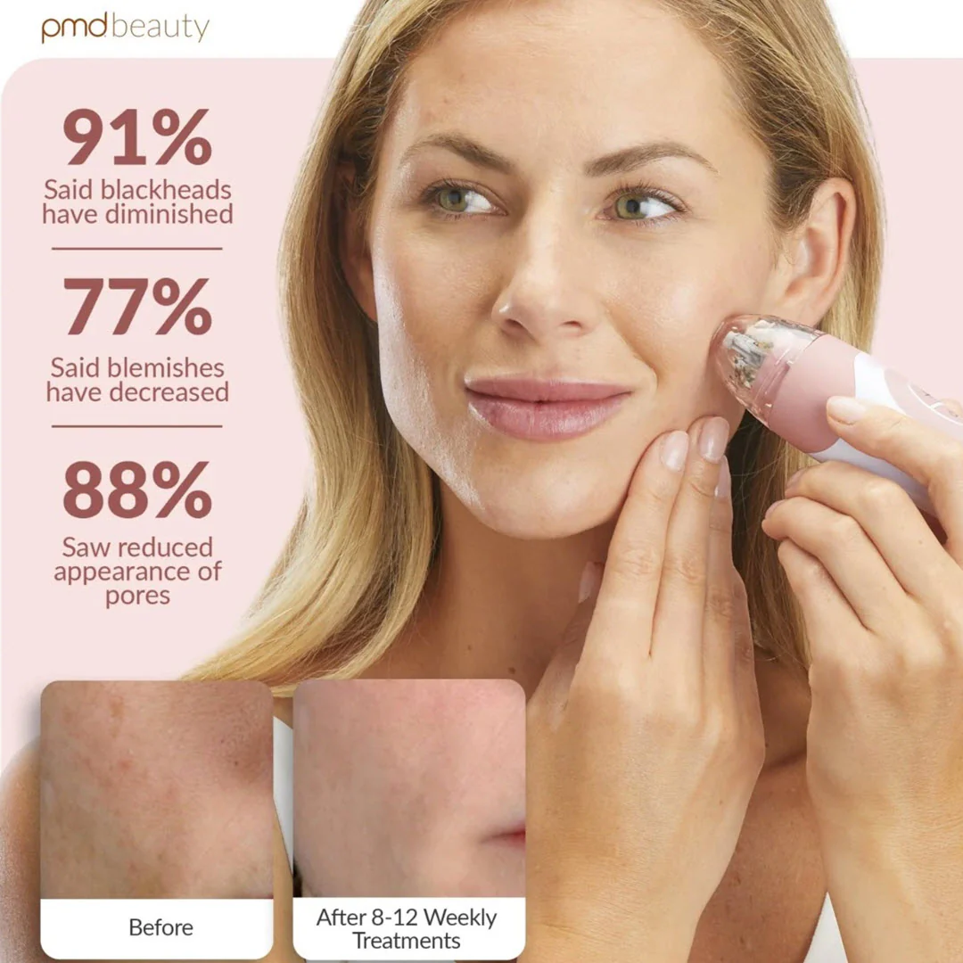 PMD® Personal Microderm Elite Pro - Rose - Image 3