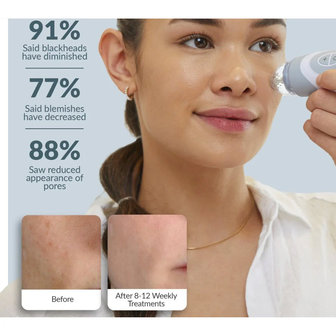 PMD® Personal Microderm Elite Pro - London Fog Grey - Image 4