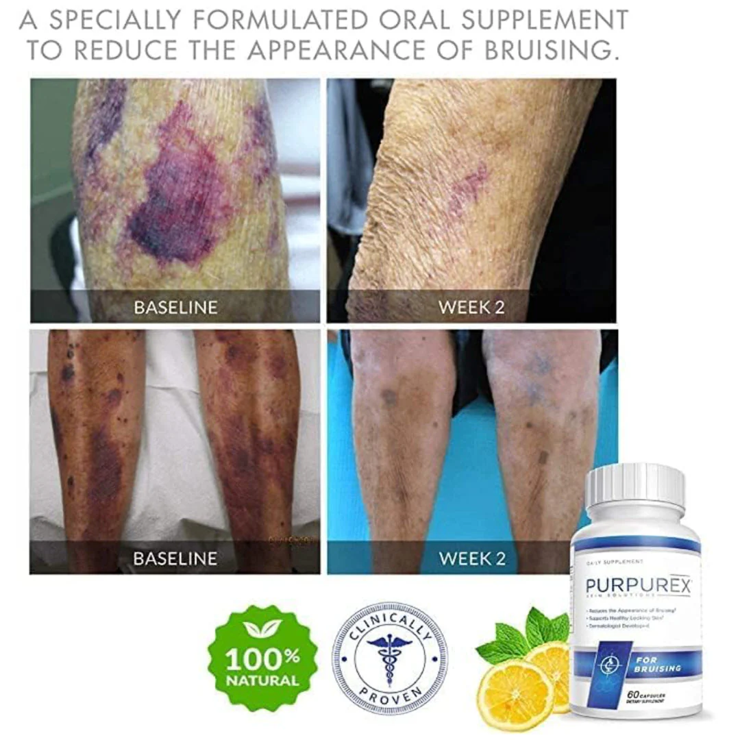 Purpurex® Daily Supplement for Bruising 60 Capsules - Image 3