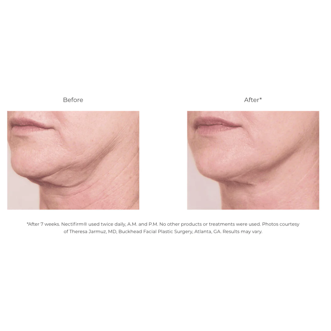 Revision® Nectifirm® 1.7 oz - Image 3