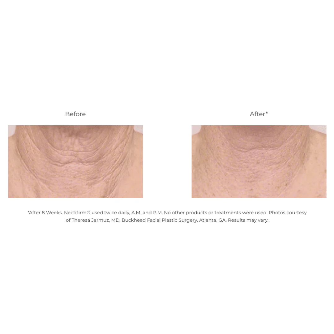 Revision® Nectifirm® 1.7 oz - Image 4