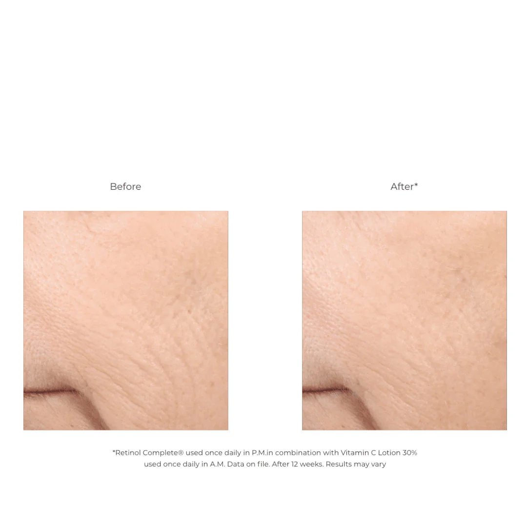 Revision® Vitamin C Lotion 30% - Image 3