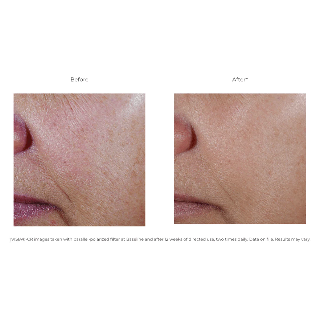Revision® C+ Correcting Complex 30% 1 FL OZ - Image 3