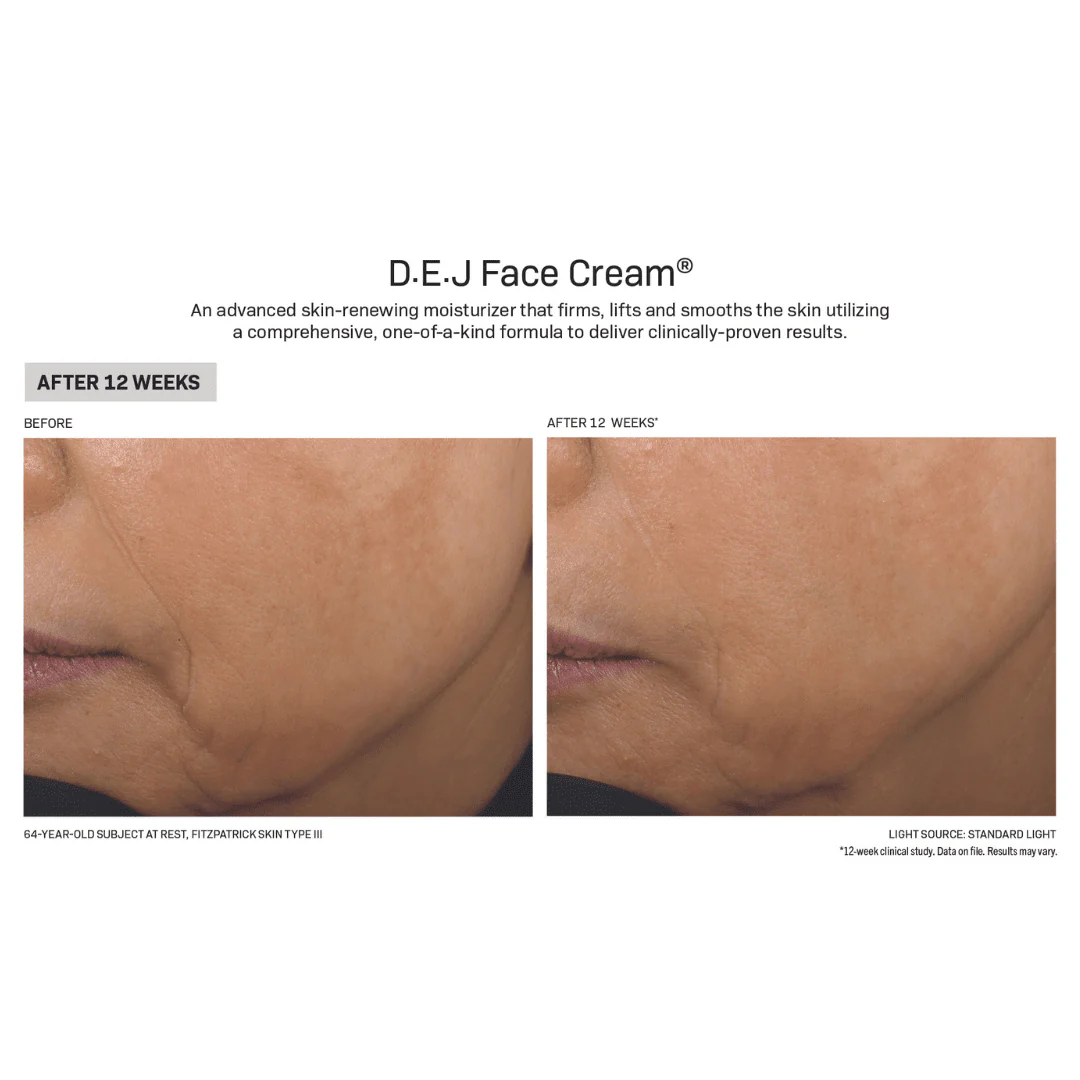 Revision® D.E.J Face Cream 1.7 OZ - Image 4