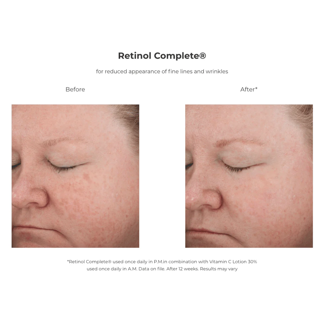 Revision® Retinol Complete® 1.0 - Image 3