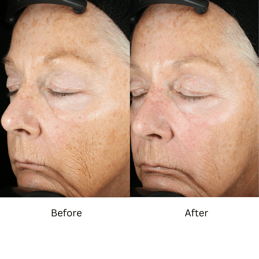 ZO® Wrinkle + Texture Repair 1.7 Fl. Oz. - Image 4