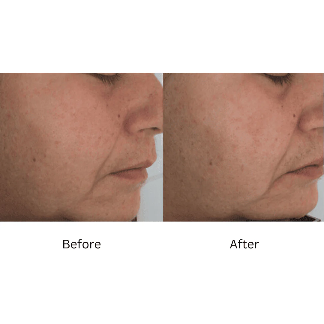 ZO® Firming Serum 1.6 Fl. Oz. - Image 4