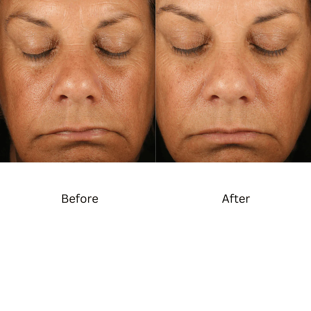 ZO® Retinol Skin Brightener 1% 30 mL / 1 Fl. Oz. - Image 4